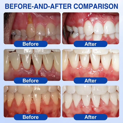 Give your gumline the extra care it deserves.