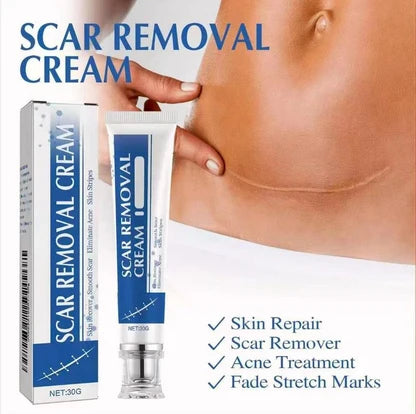 Professional Scar Removal Cream