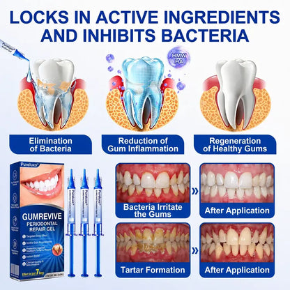 Give your gumline the extra care it deserves.
